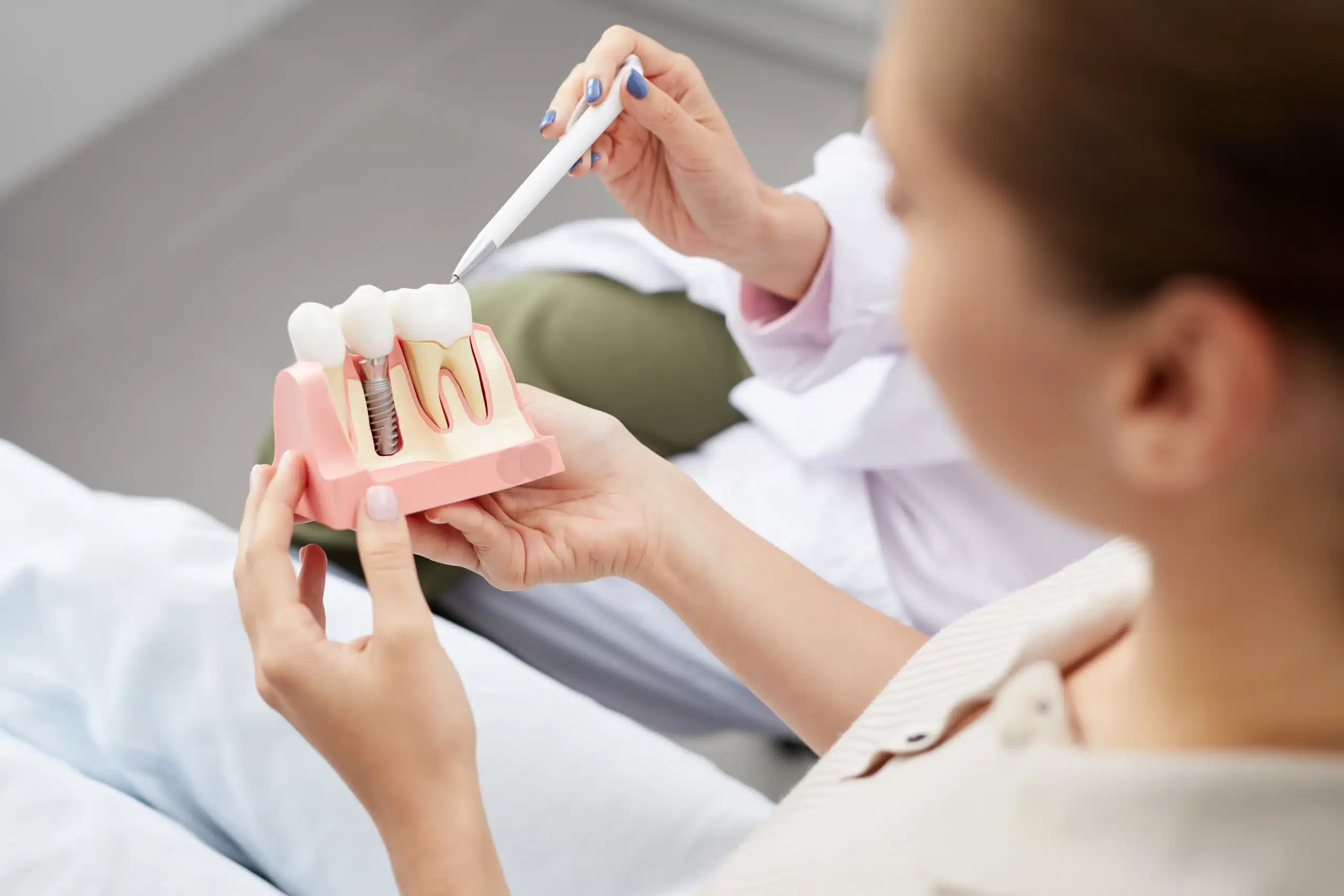 How Long Does A Dental Implant Procedure Take