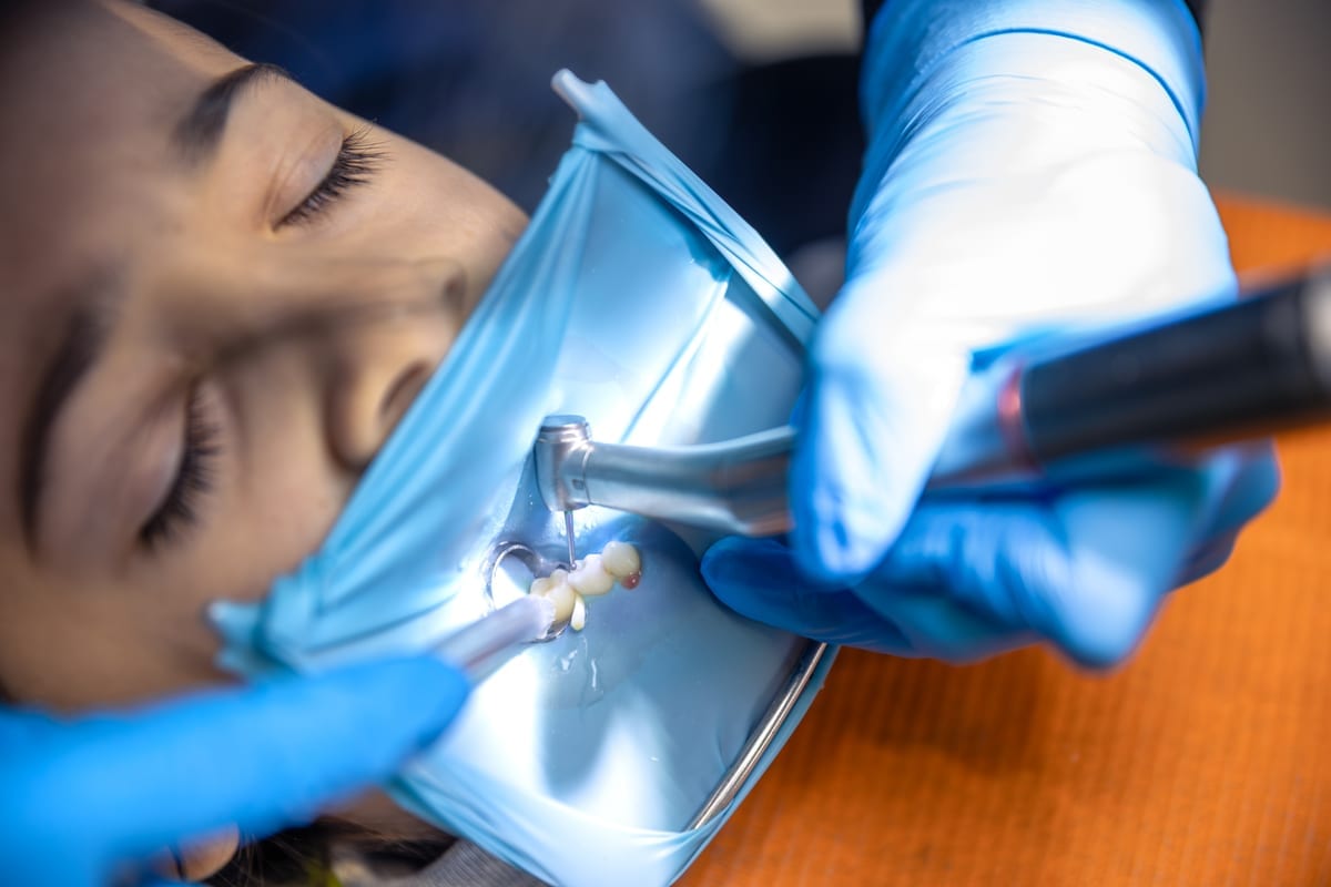 Root Canal Treatment in Longview